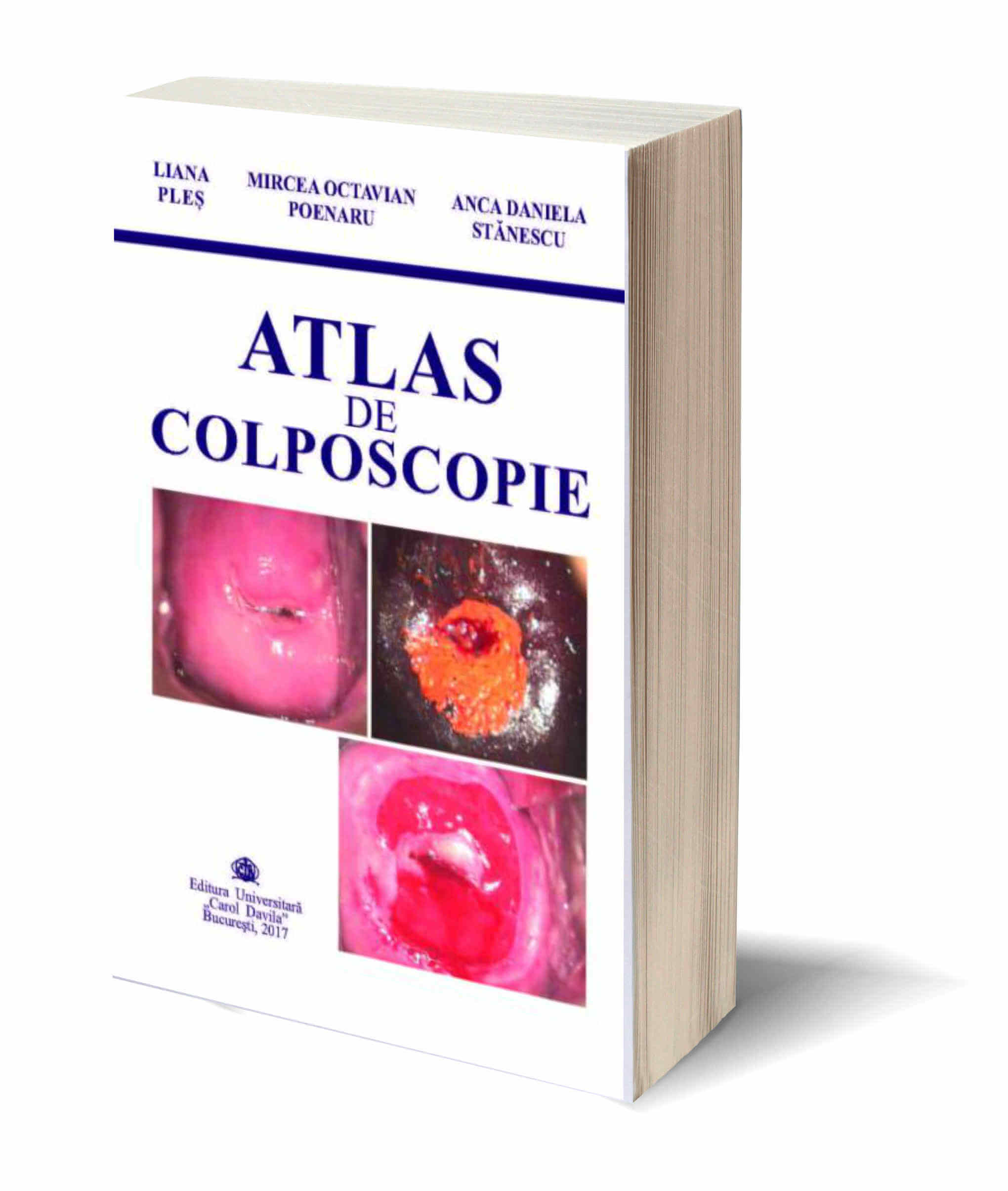 Atlas de Colposcopie