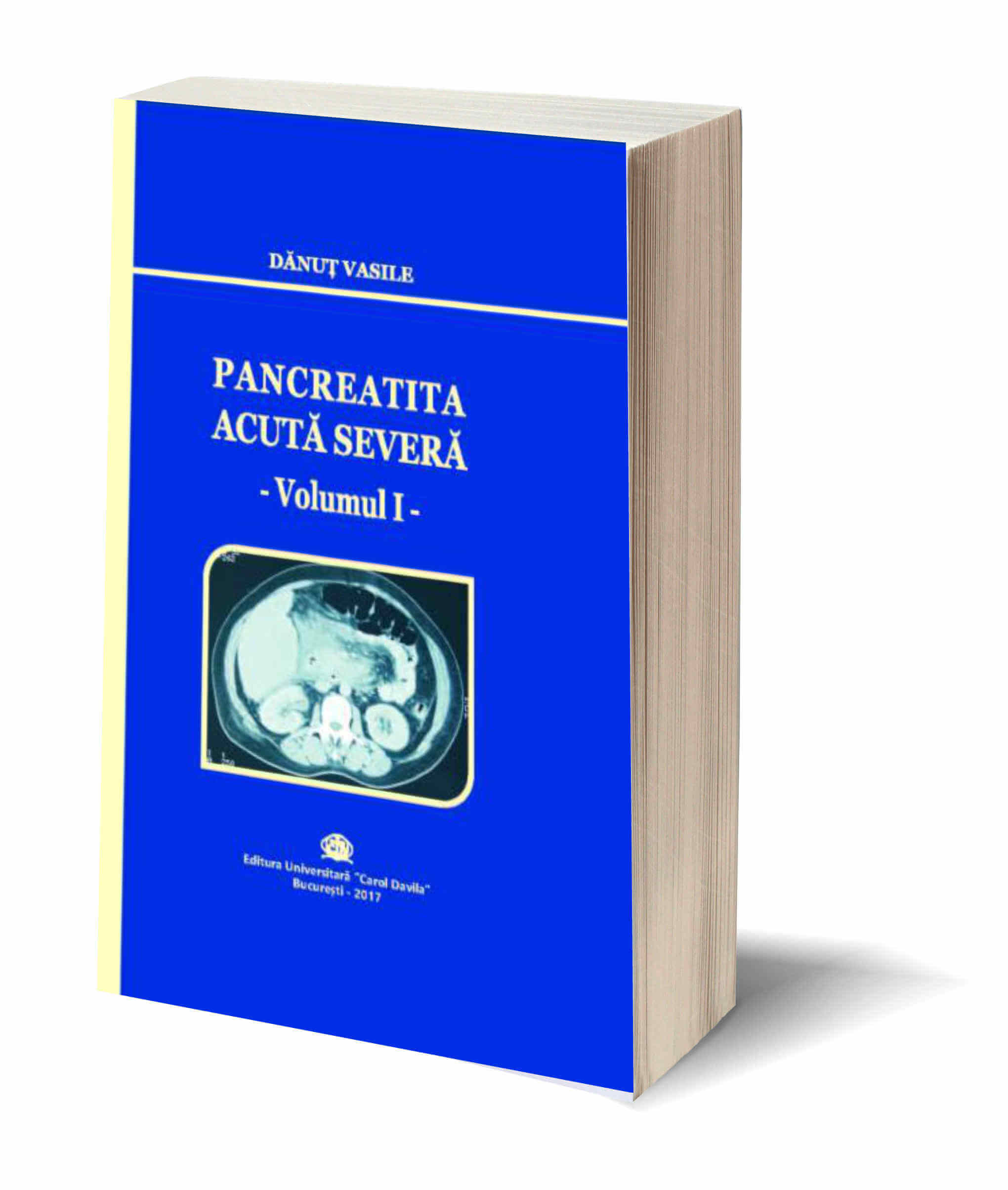 Pancreatica Acuta Severa Vol. I